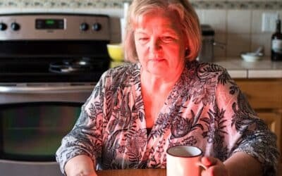 11 Powerful Dry Skin in Winter Remedies That Truly Work for Young and Mature